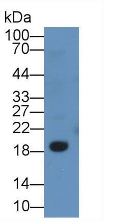 CD3 delta Antibody (C6)