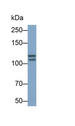 Insulysin/IDE Antibody (C1)