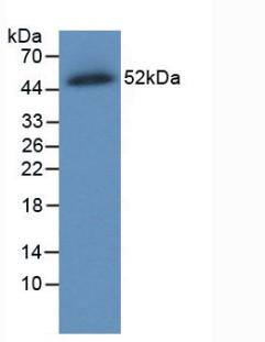 Ferroportin/SLC40A1 Antibody (C7)