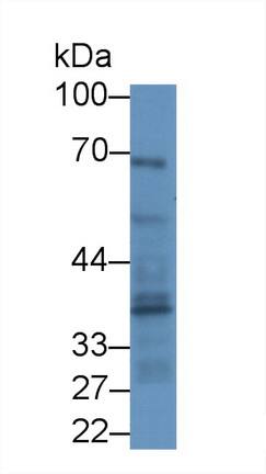 Ferroportin/SLC40A1 Antibody (C7)