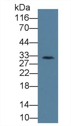 KIR2DS4/CD158i Antibody (C3)