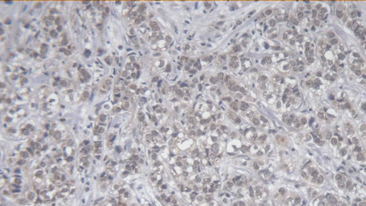 KIR2DS4/CD158i Antibody (C3)