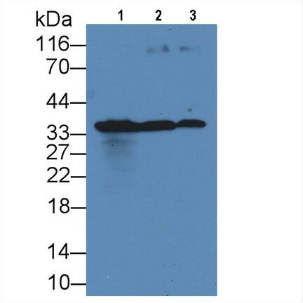 KIR2DS4/CD158i Antibody (C7)