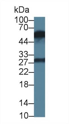 KIR2DS4/CD158i Antibody (C2)