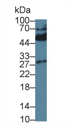 KIR2DS4/CD158i Antibody (C2)