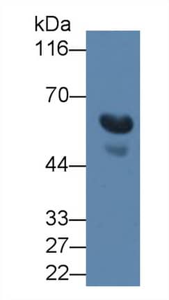 TGF-beta 3 Antibody (C14)