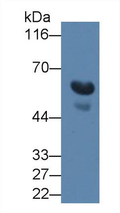 TGF-beta 3 Antibody (C14)