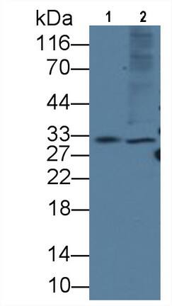 KIR2DS4/CD158i Antibody (C4)