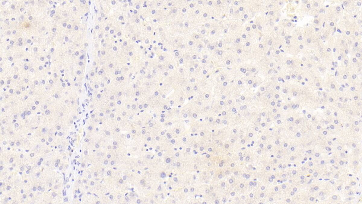 Siglec-8 Antibody (D1)