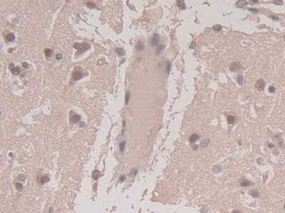 TGF-beta 3 Antibody (C15)