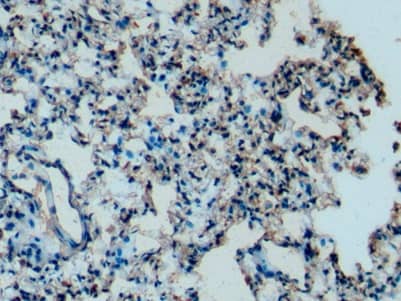 Apolipoprotein C1 Antibody (C3)