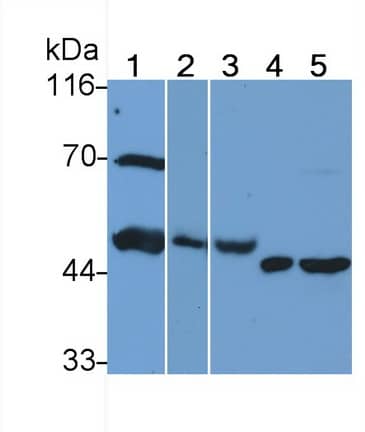 Heparanase/HPSE Antibody (C3)