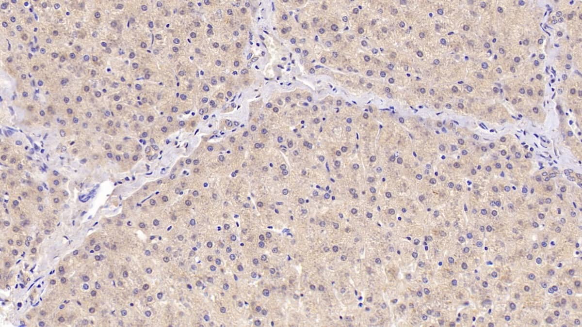 Angiogenin Antibody (C6)