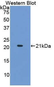 COL15A1 Antibody (E7)