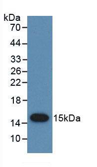 PSCA Antibody (C1)