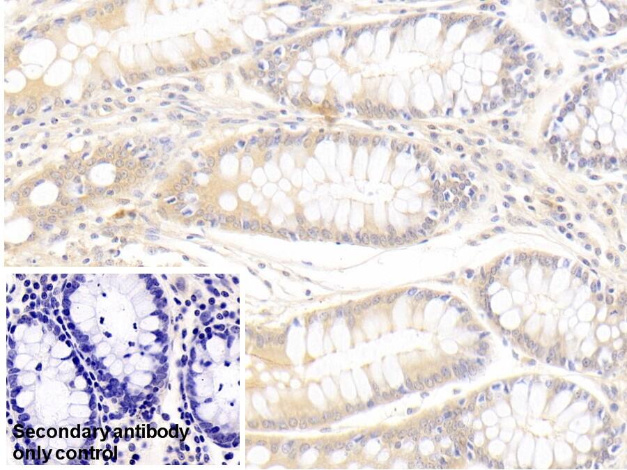 sFRP-4 Antibody (5#)