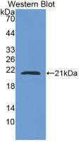 CAP2 Antibody (6#)