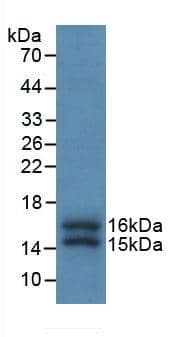 FKBP12 Antibody (E3)