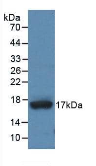 ADAMTS4 Antibody (1#)