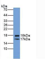 ITIH4 Antibody (5#)