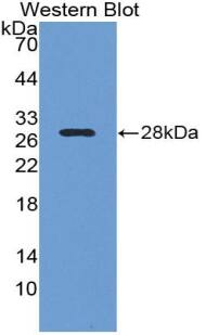 LOXL1 Antibody (C1)