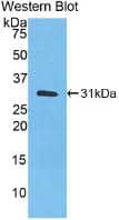 Carbonic Anhydrase III/CA3 Antibody (C2)