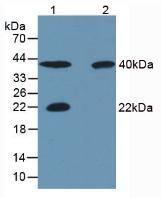 Carbonic Anhydrase III/CA3 Antibody (C2)