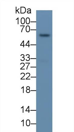 P4HA2 Antibody (C3)