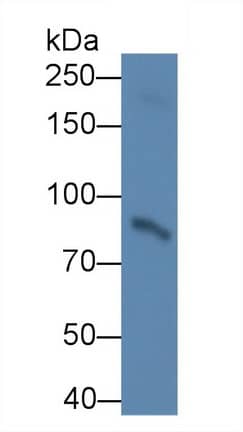 Lysine Hydroxylase 2/PLOD2 Antibody (C1)