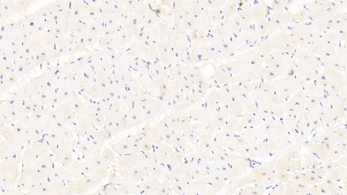 NCOA3/AIB1 Antibody (D3)