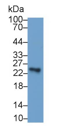 USAG1/SOSTDC1 Antibody (C1)