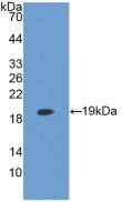 LPCAT3 Antibody (6-2#)