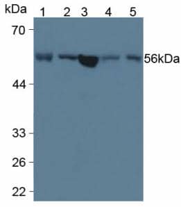 LPCAT3 Antibody (6-2#)