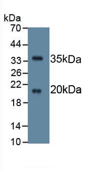 SPINK5 Antibody (C10)