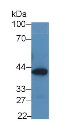 Glutaminyl-peptide Cyclotransferase/QPCT Antibody (C2)