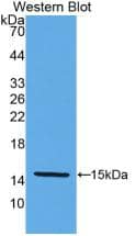 Klotho beta Antibody (8#)