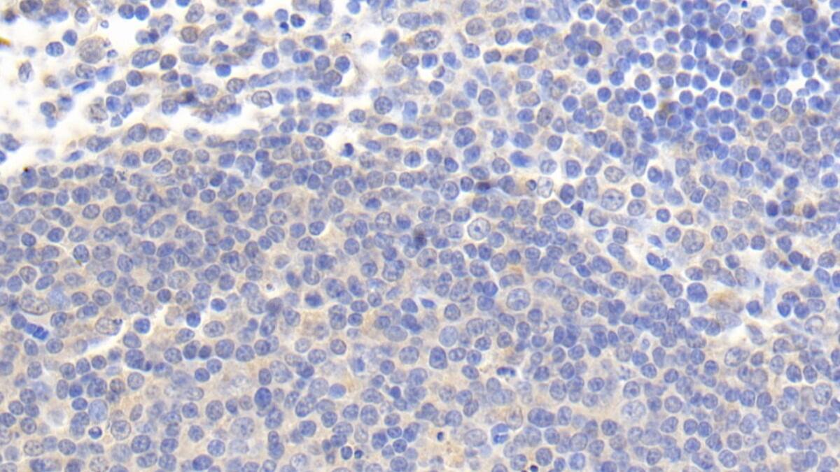 IL-4I1 Antibody (C2)