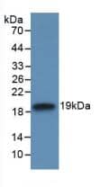 IL-18 BPa/IL18BP Antibody (5-2#)