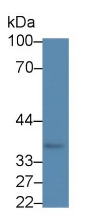 gamma-glutamyl hydrolase Antibody (C3)