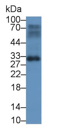 BASP1 Antibody (C2)