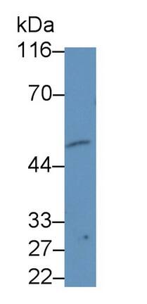 B4GALNT2 Antibody (D3)