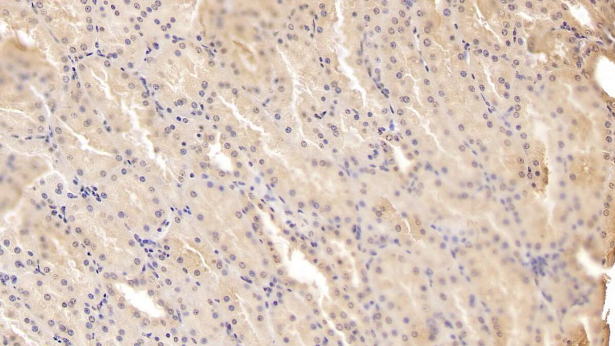 ADAMTS9 Antibody (D2)