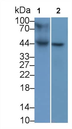 HLA B Antibody (C1)