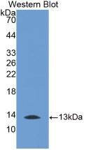 Melatonin R1A/MT1/MTNR1A Antibody (1#)