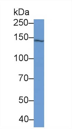 Isoleucyl tRNA synthetase Antibody (C1)