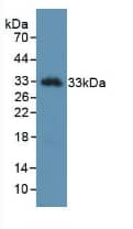 Kallikrein 2 Antibody (D3)