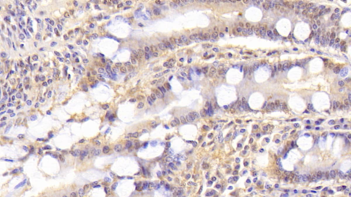 Syntenin 2 Antibody (C1)