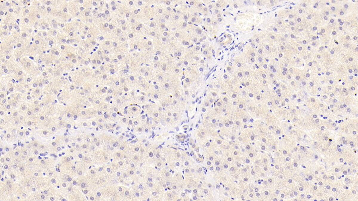 Syntenin 2 Antibody (C1)