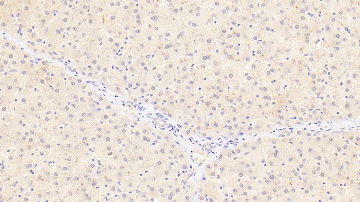 Monoglyceride Lipase Antibody (D3)