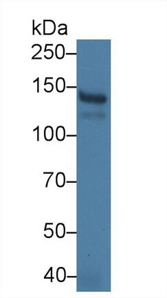 PLA2R1 Antibody (C6)